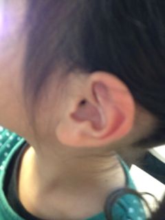 美和ちゃんの耳