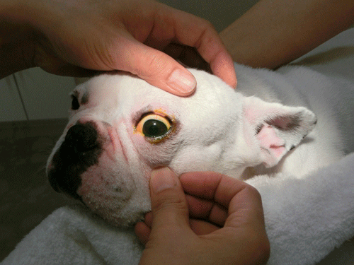 眼球の検査